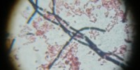 image: Same School, New Infection?