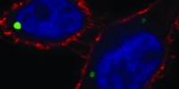 image: Obscure Organelle in Stem Cells and Cancer