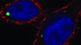 Obscure Organelle in Stem Cells and Cancer image: Obscure Organelle in Stem Cells and Cancer