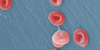 image: Europe Pours $41 Million Into Epigenome