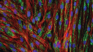 Skipping Pluripotency image: Skipping Pluripotency