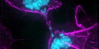 image: Missegregation Linked to DNA Damage
