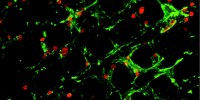 image: Next Generation: Neuronal Monkey Bars