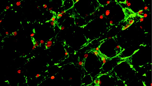 Next Generation: Neuronal Monkey Bars image: Next Generation: Neuronal Monkey Bars