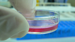 New Drug Toxicity Chip image: New Drug Toxicity Chip