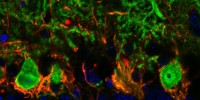 image: Next Generation: All-In-One In Vivo Scope