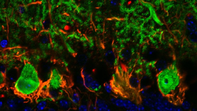 Next Generation: All-In-One In Vivo Scope image: Next Generation: All-In-One In Vivo Scope