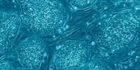image: Stem Cell Funding in Court…Again