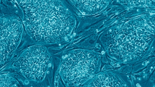First hESC Trial Kaput image: First hESC Trial Kaput