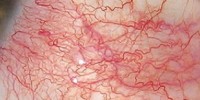 image: Plastics That Heal Like Skin