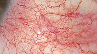 Plastics That Heal Like Skin image: Plastics That Heal Like Skin