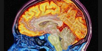 image: New Brain Stem Cell