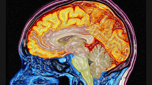 New Genes, New Brain image: New Genes, New Brain