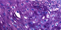 image: MicroRNAs Prevent Cell Reprogramming