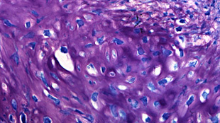 MicroRNAs Prevent Cell Reprogramming image: MicroRNAs Prevent Cell Reprogramming