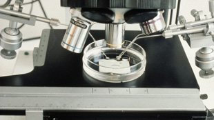 European Stem Cell Patent Ban Good? image: European Stem Cell Patent Ban Good?