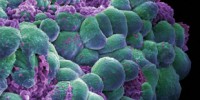 image: BRCA1 Further Elucidated