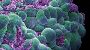 Secrets of Breast Cancer Resistance image: Secrets of Breast Cancer Resistance