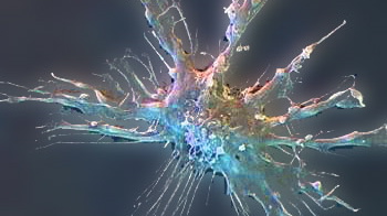 Immunologists Take Home Nobel image: Immunologists Take Home Nobel