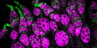 image: <em>Wolbachia</em> Boost Stem Cell Production