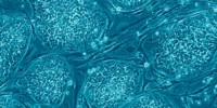 image: No European Patents for Stem Cells