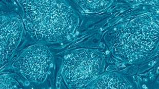 No European Patents for Stem Cells image: No European Patents for Stem Cells