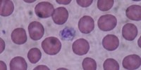image: Platelets Flag Bacteria in Mice