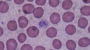 Platelets Flag Bacteria in Mice image: Platelets Flag Bacteria in Mice