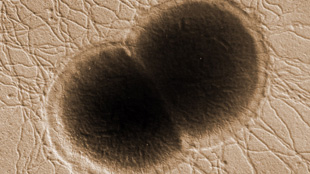 Bacterial Identity Crisis image: Bacterial Identity Crisis