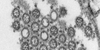 image: Double Flu Infections Pose Risk