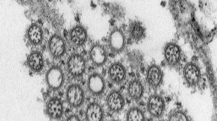 Double Flu Infections Pose Risk image: Double Flu Infections Pose Risk