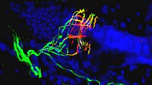 Deafness Gene Heightens Touch image: Deafness Gene Heightens Touch