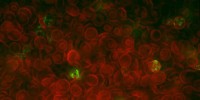 image: How Blood Cells Thwart Malaria