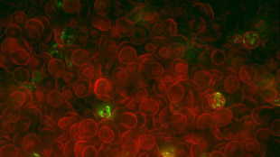 How Blood Cells Thwart Malaria image: How Blood Cells Thwart Malaria