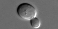 image: A New Model of Yeast Aging
