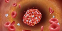 image: A Cancer-Heart Disease Link