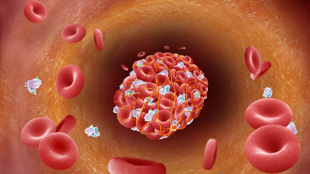 A Cancer-Heart Disease Link image: A Cancer-Heart Disease Link