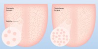 image: Supertaster Anatomy
