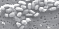 image: Arsenic Bug's Genome Sequenced