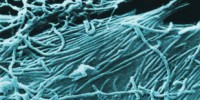 image: A Possible Ebola Vaccine?