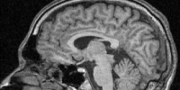 image: Neuroscience Not Ready for the Courtroom