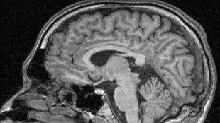 Neuroscience Not Ready for the Courtroom image: Neuroscience Not Ready for the Courtroom