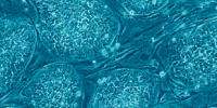image: Stem Cells: Old vs. New
