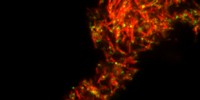 image: Semen Protein Boosts HIV Transmission
