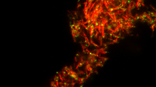 Semen Protein Boosts HIV Transmission image: Semen Protein Boosts HIV Transmission