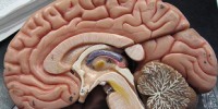 image: Brain Evolution at a Distance