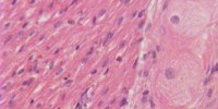 image: Stem Cells Traced To Heart