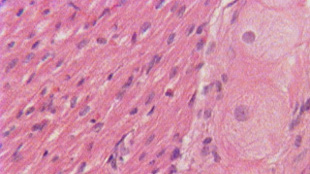 Stem Cells Traced To Heart image: Stem Cells Traced To Heart
