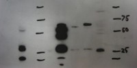 image: Blot Figure Fraud