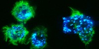 image: Skin Cells Cause Cancer?